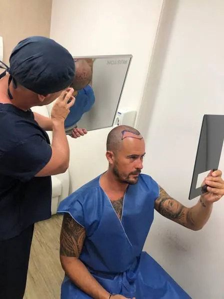 Paulo Vilhena com roupa clínica azul, cabeça raspada e linha frontal demarcada, segurando um espelho ao lado do médico.